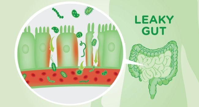 4 Supplements to Help Heal a Leaky Gut | kulture.store